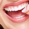 filo-interdentale-expanding-floss-eurosima