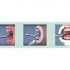 oral bio filter