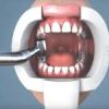 oral bio filter