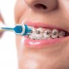 pro-ortho-spazzolino